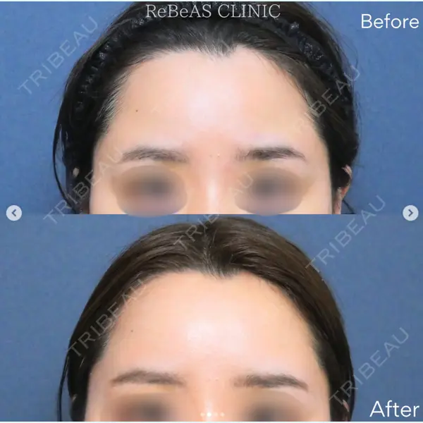 ReBeAS CLINICの症例