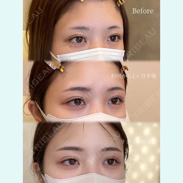 REVO CLINIC PLUSの症例