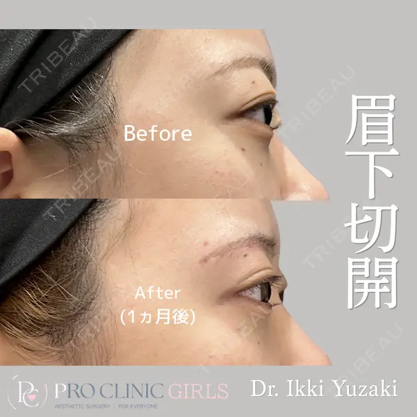 PRO CLINIC プロクリニック 銀座院 柚﨑 一輝医師の症例