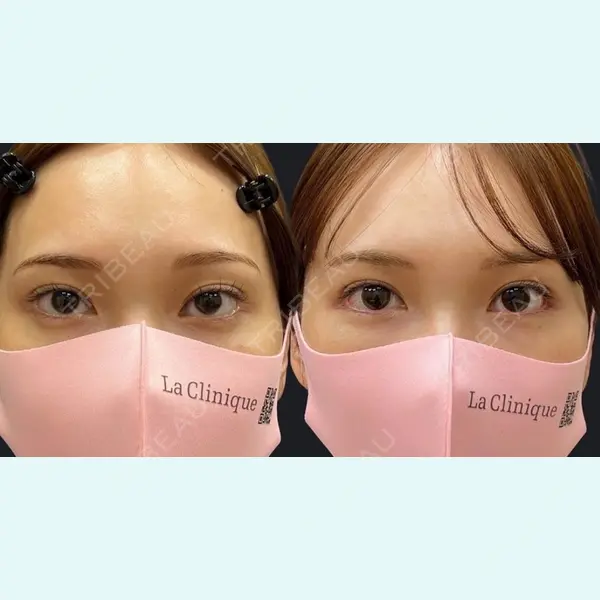 La Clinique Osaka 【ラクリニック大阪】 長瀬 ⼤蔵医師の症例