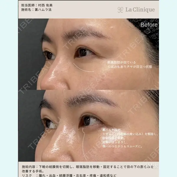 La Clinique Osaka 【ラクリニック大阪】 村西　佑美医師の症例