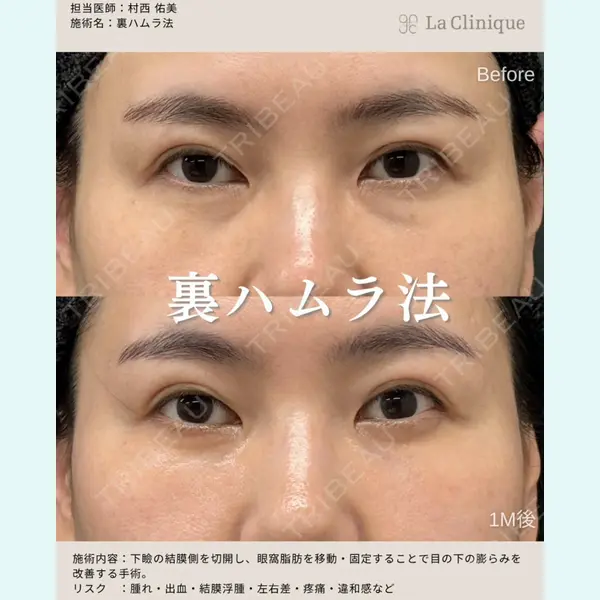La Clinique Osaka 【ラクリニック大阪】 村西　佑美医師の症例