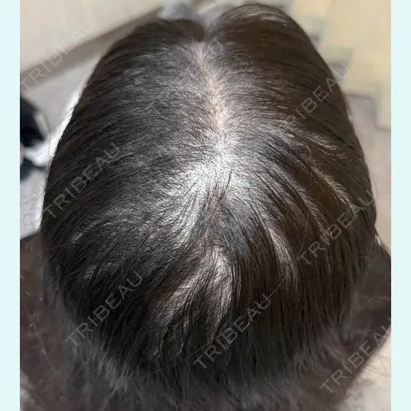 One Hair Artmake(One Beauty Clinic) 大塚 みさ医師の症例