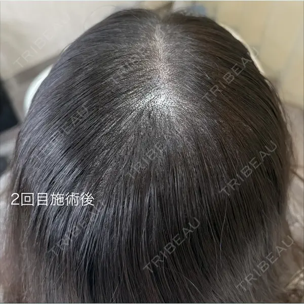 One Hair Artmake(One Beauty Clinic) 大塚 みさ医師の症例