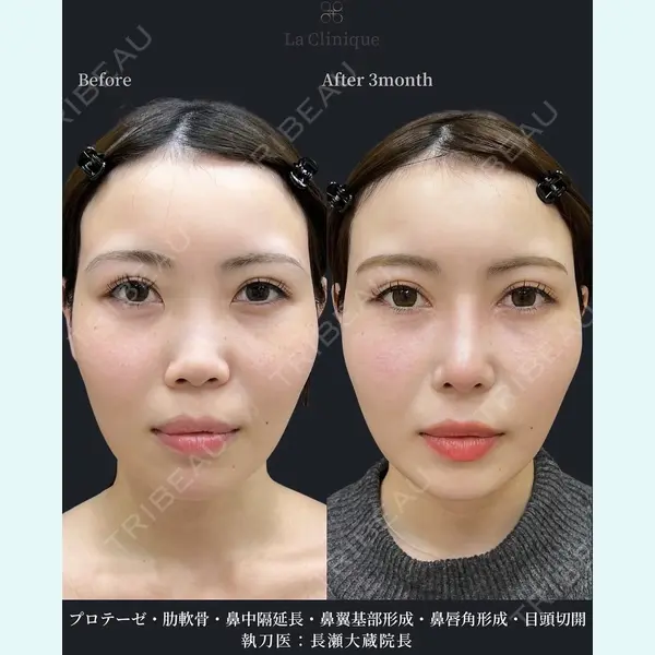 La Clinique Osaka 【ラクリニック大阪】 長瀬 ⼤蔵医師の症例