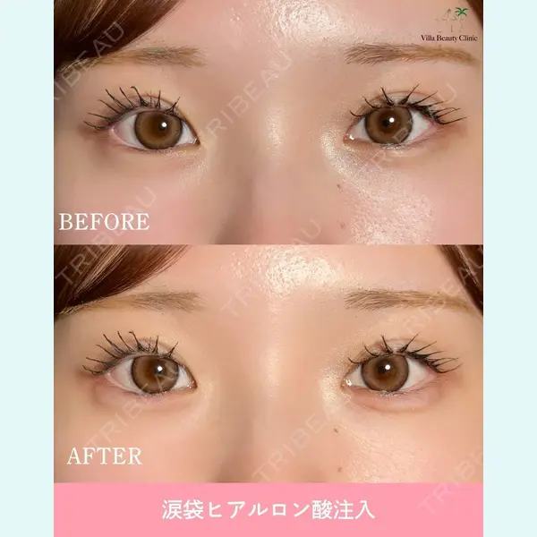 博多美容外科/美容皮膚科 ビラビューティークリニック 大村 亞蘭医師の症例
