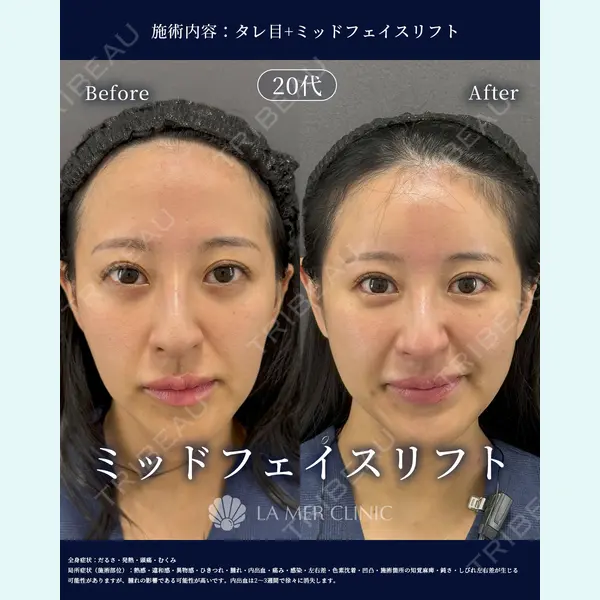 LA MER CLINICの症例