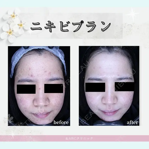 SUBCLi（＆ABCクリニック）の症例