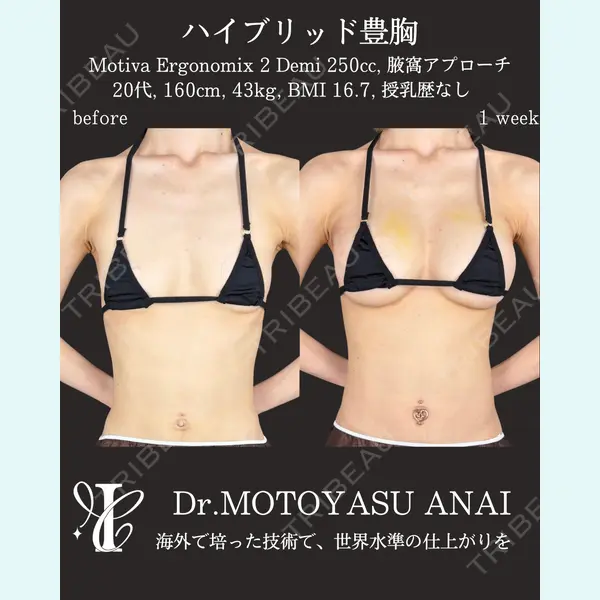 IANA CLINIC 穴井 元康医師の症例