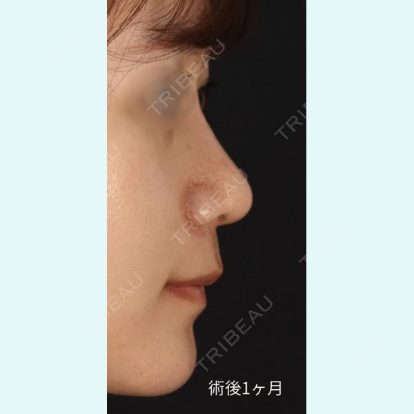 ユア美容クリニック 福岡院 吉田 聖医師の症例