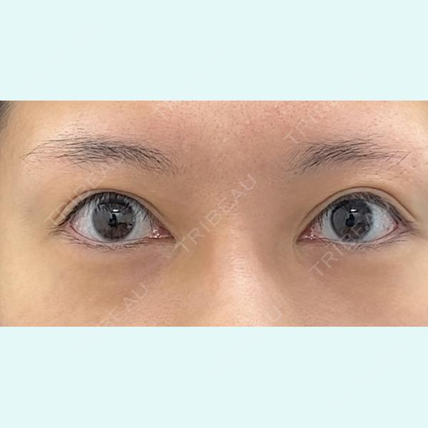 ユア美容クリニック 銀座院 上原 憂大医師の症例