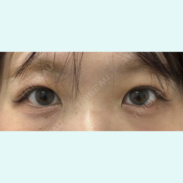 ユア美容クリニック 福岡院 吉田 聖医師の症例