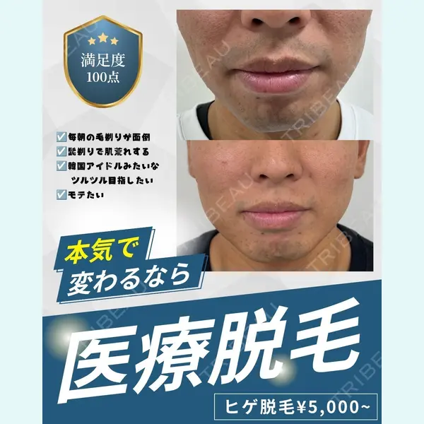 滋賀美容皮膚科クリニックの症例