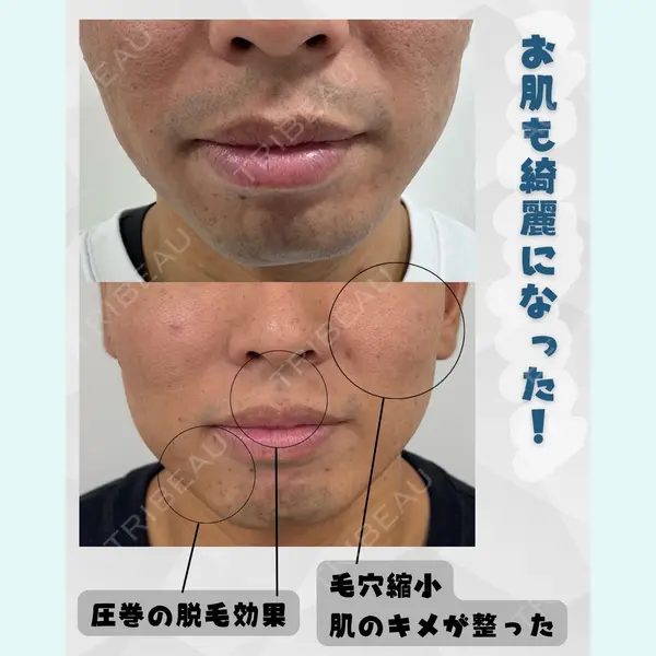 滋賀美容皮膚科クリニックの症例