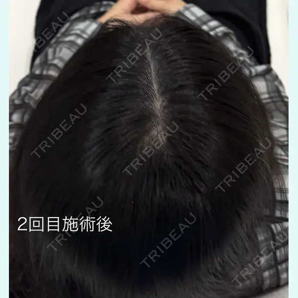 One Hair Artmake(One Beauty Clinic) 大塚 みさ医師の症例