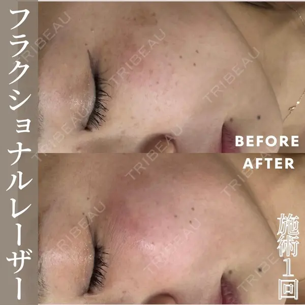 滋賀美容皮膚科クリニックの症例