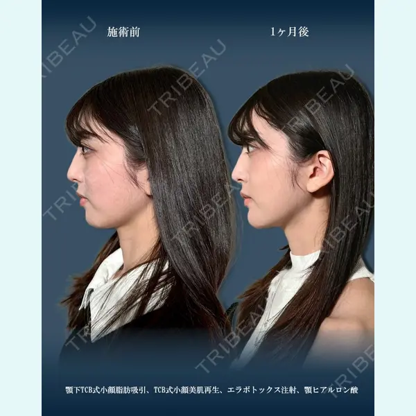 TCB東京中央美容外科 渋谷西口院の症例