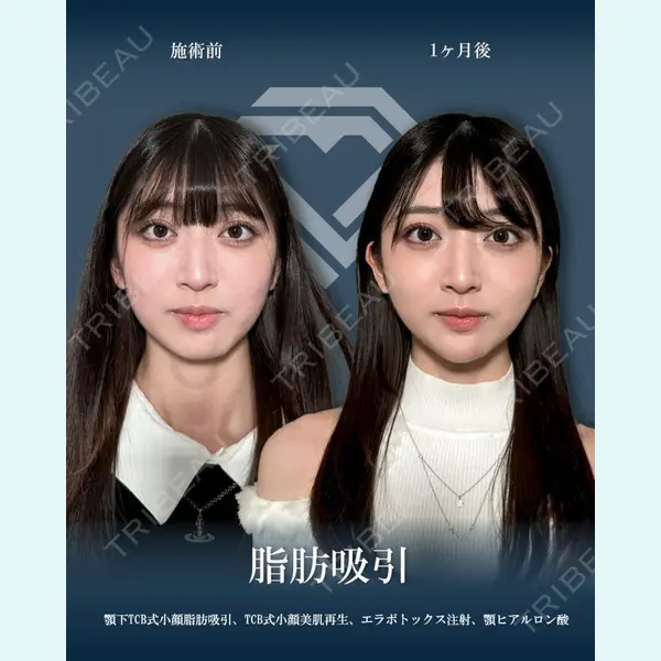 TCB東京中央美容外科 渋谷西口院の症例