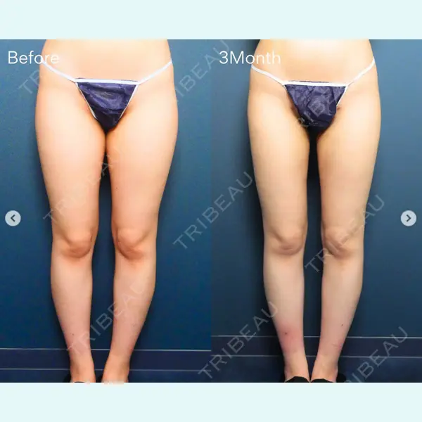 ReBeAS CLINICの症例
