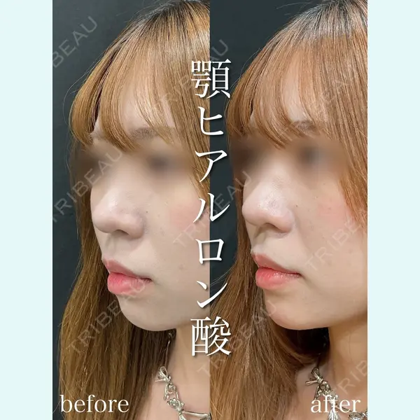 アデル美容クリニックの症例