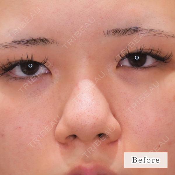 CLEAN BEAUTY CLINIC TokyoAzabu 三田 亜耶医師の症例