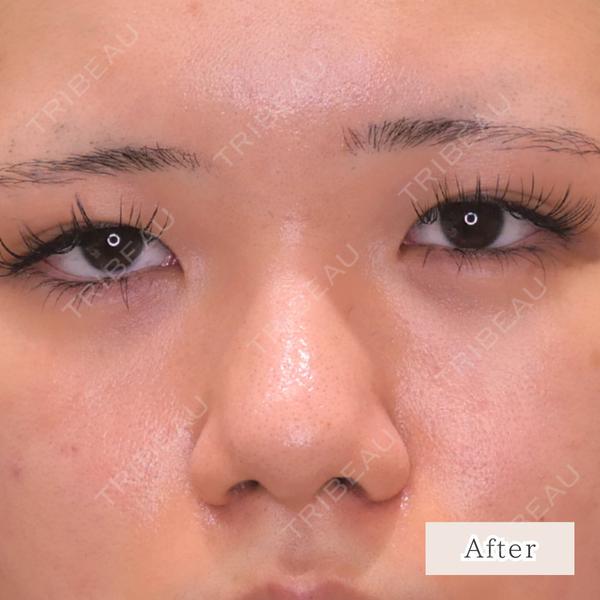 CLEAN BEAUTY CLINIC TokyoAzabu 三田 亜耶医師の症例