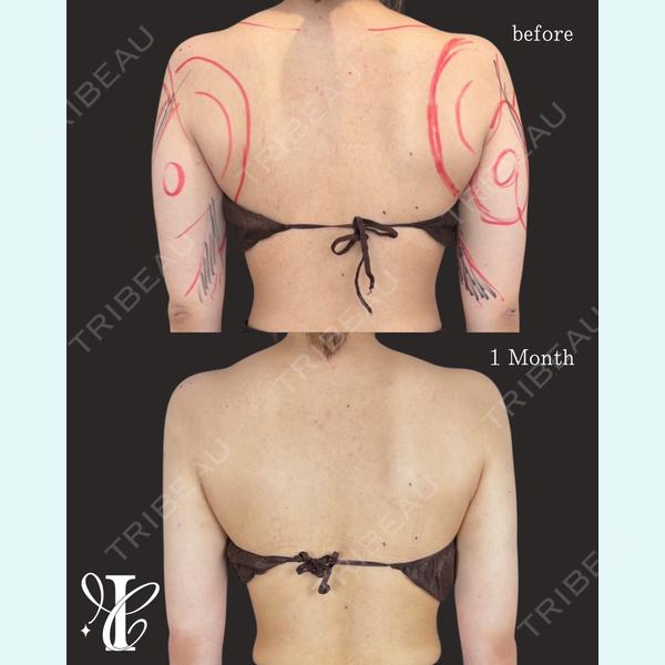 IANA CLINIC 穴井 元康医師の症例