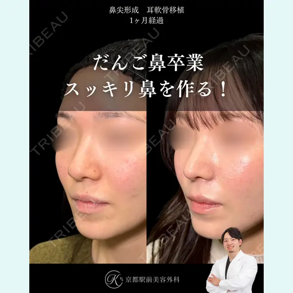 京都駅前美容外科 龍山 侑季史医師の症例