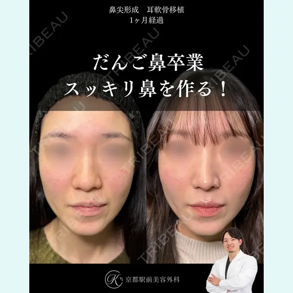 京都駅前美容外科 龍山 侑季史医師の症例