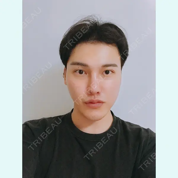 DA美容外科 LEE SANG WOO医師の症例
