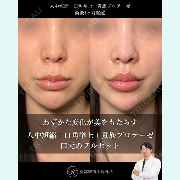 京都駅前美容外科 龍山 侑季史医師の症例