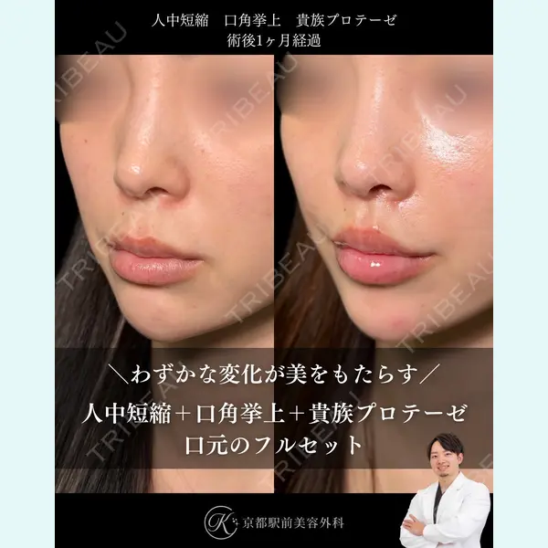 京都駅前美容外科 龍山 侑季史医師の症例
