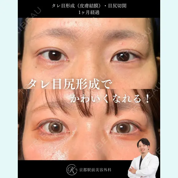 京都駅前美容外科 龍山 侑季史医師の症例