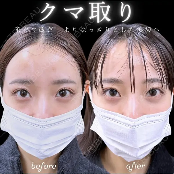 東京BELLEZZAクリニック 根本 尚久医師の症例