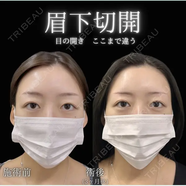 東京BELLEZZAクリニック 根本 尚久医師の症例