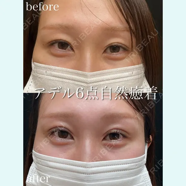 アデル美容クリニックの症例