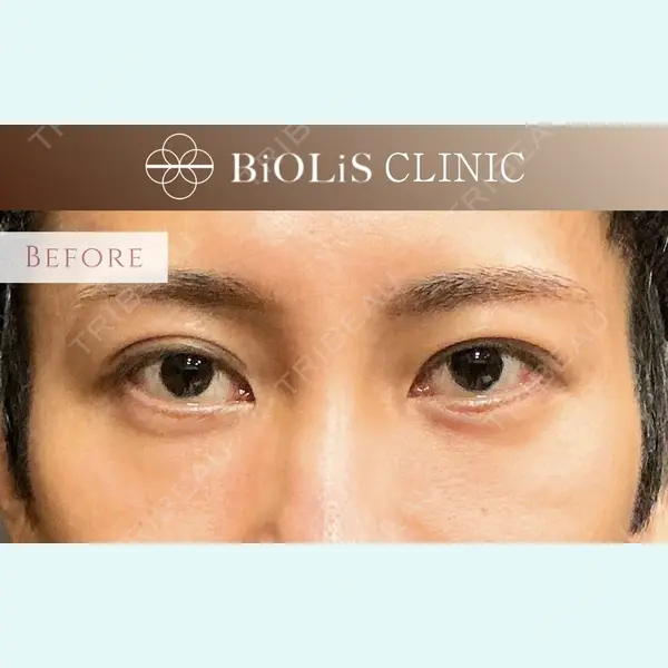 BiOLiS CLINIC 金子　俊彦医師の症例