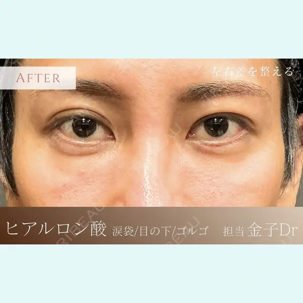 BiOLiS CLINIC 金子　俊彦医師の症例