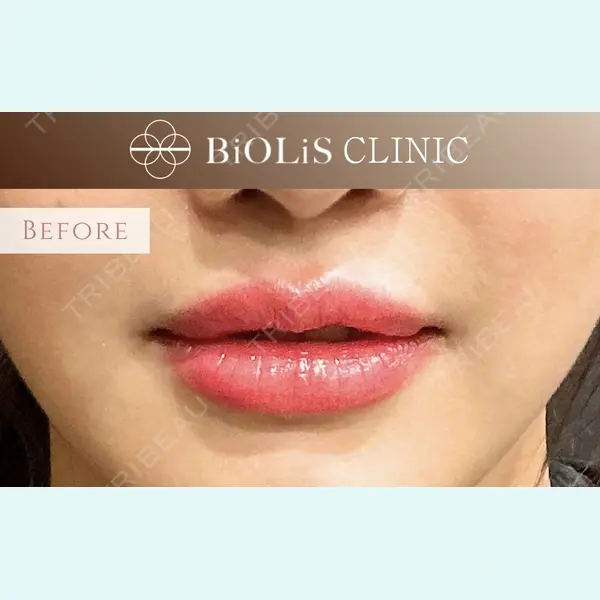 BiOLiS CLINICの症例