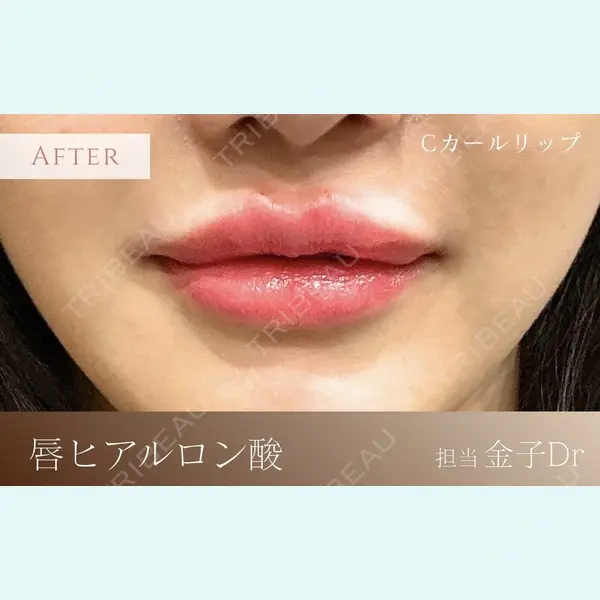 BiOLiS CLINICの症例