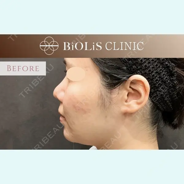 BiOLiS CLINICの症例