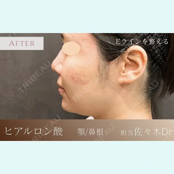 BiOLiS CLINICの症例