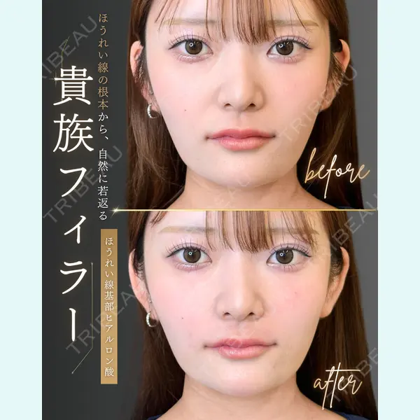 ルラ美容クリニック 高崎院 井田 翔太医師の症例