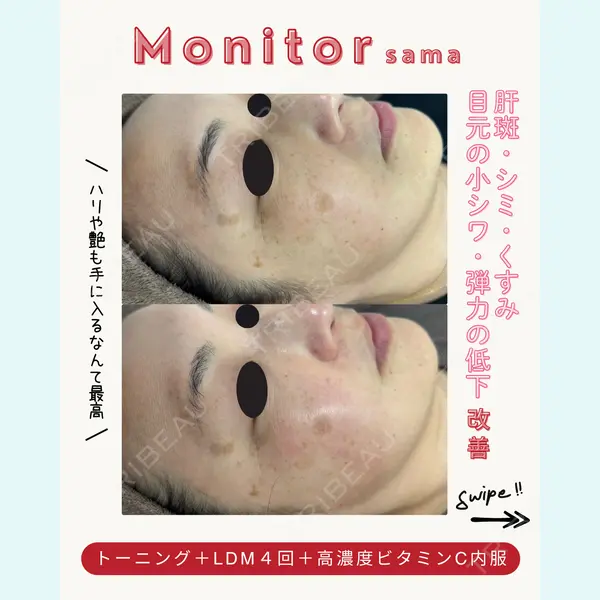 滋賀美容皮膚科クリニックの症例