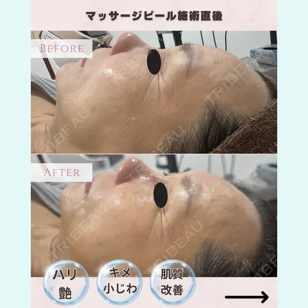 滋賀美容皮膚科クリニックの症例