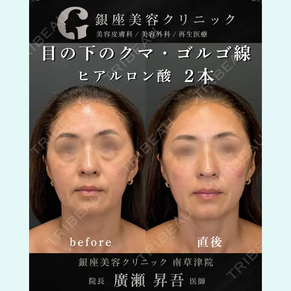 銀座美容クリニック 南草津院 廣瀨 昇吾医師の症例