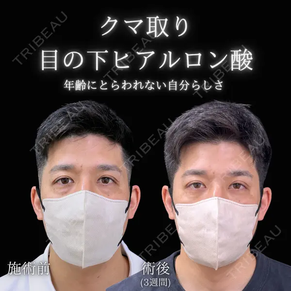 東京BELLEZZAクリニック 根本 尚久医師の症例