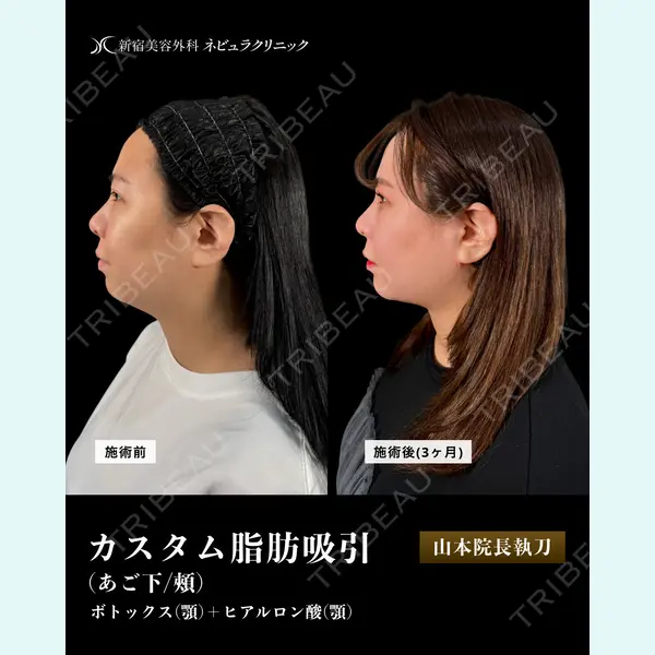 新宿美容外科ネビュラクリニック 山本 紘子医師の症例