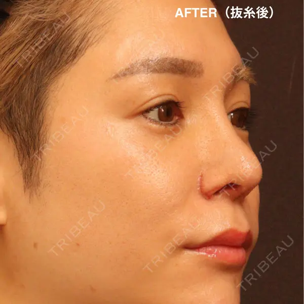 OMOSUKI.NAGOYA（表参道スキンクリニック） 亀水優子医師の症例