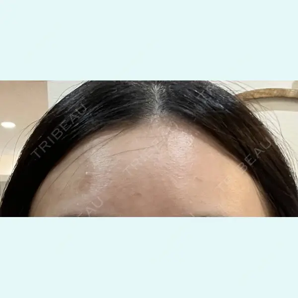 Evergreen medical clinic 沼田 櫻華医師の症例